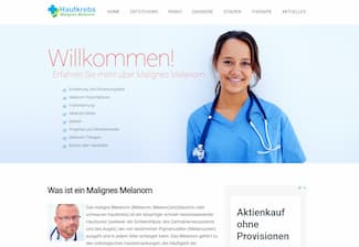 Malignes Melanom - Erkennung und Behandlung